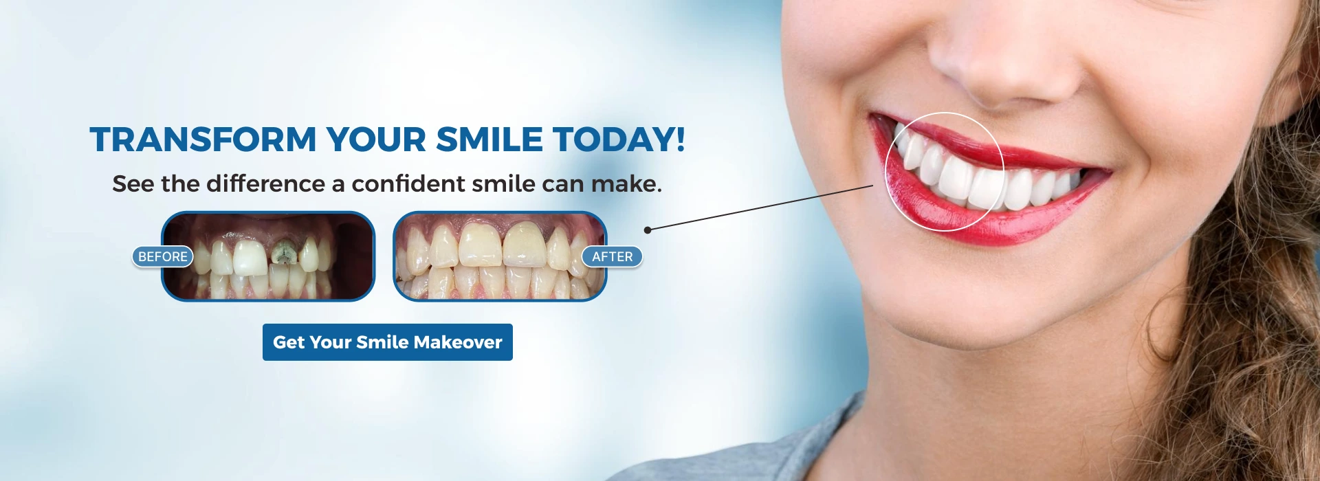 Smile Design & Makeovers (1)